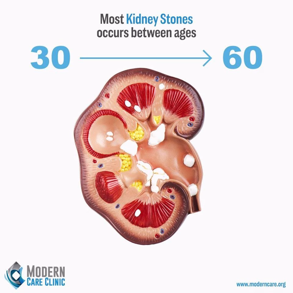 At What Age Kidney Stones Occur?