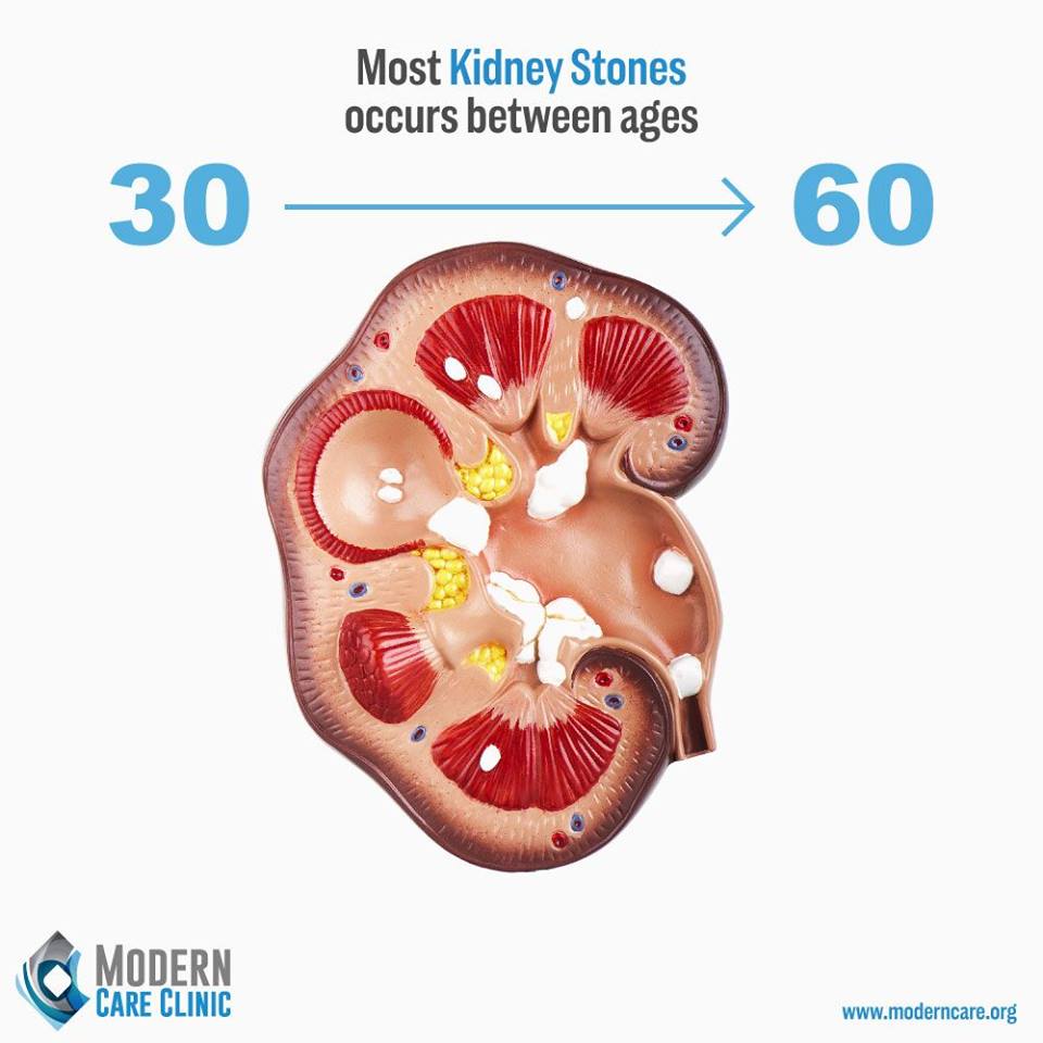 At What Age Kidney Stones Occur?