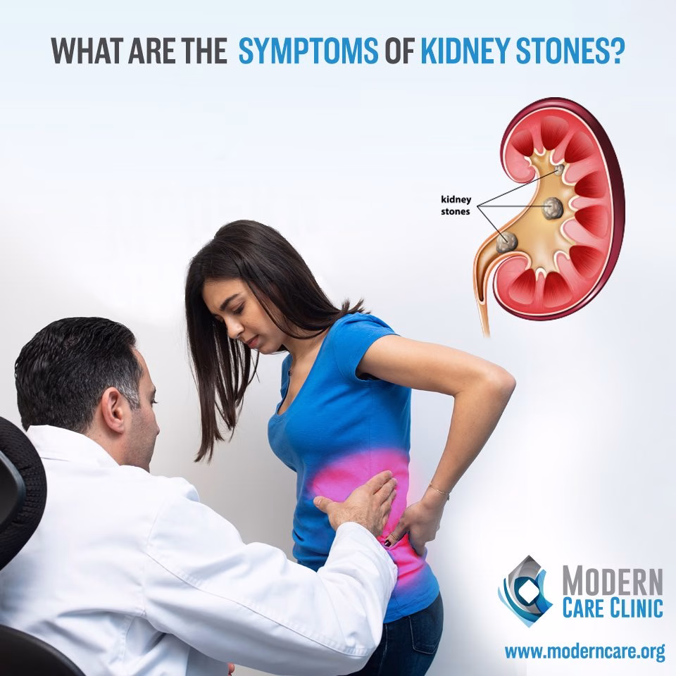 what are the symptoms of the kidney stones 1