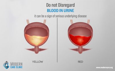 Blood in urine!