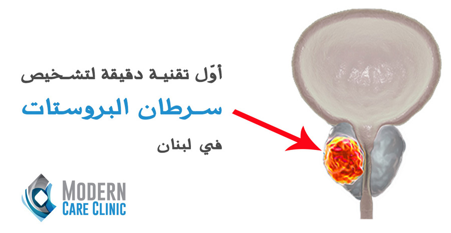 أوّل تقنية دقيقة لتشخيص سرطان البروستات في لبنان