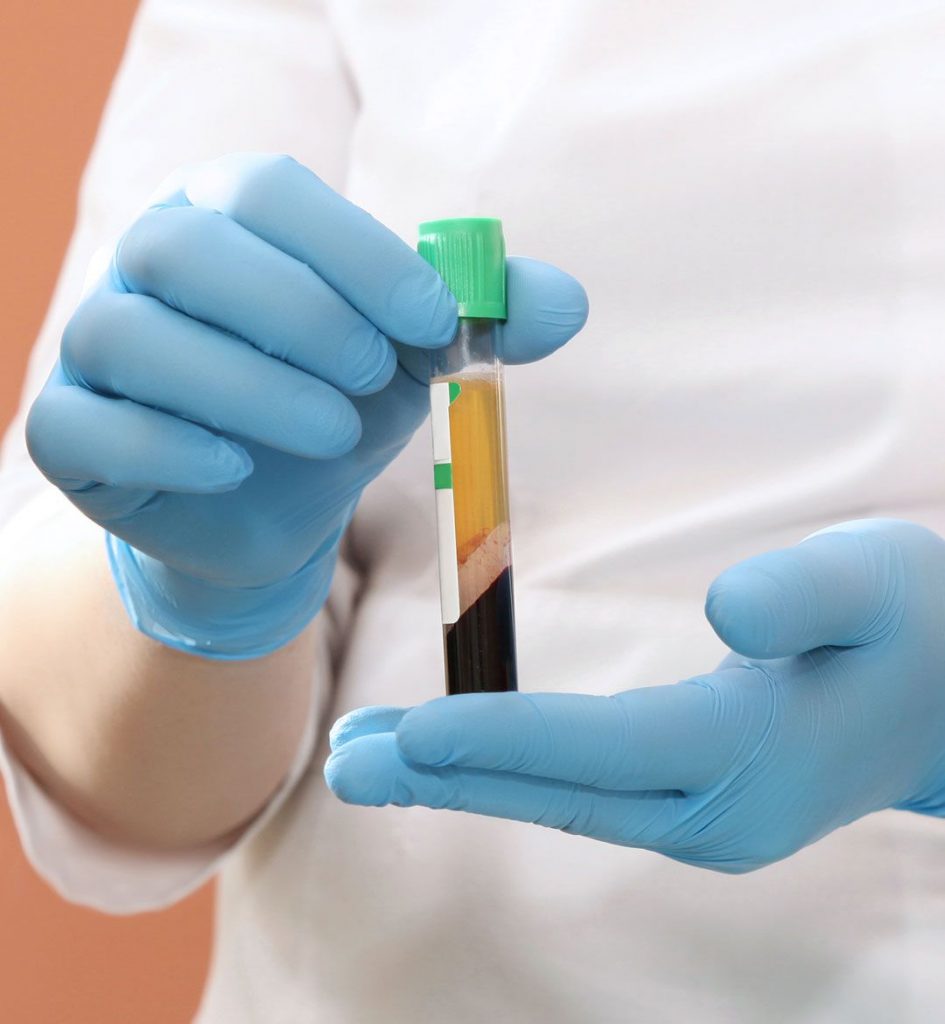 Platelet-Rich Plasma (PRP) for urine incontinence
