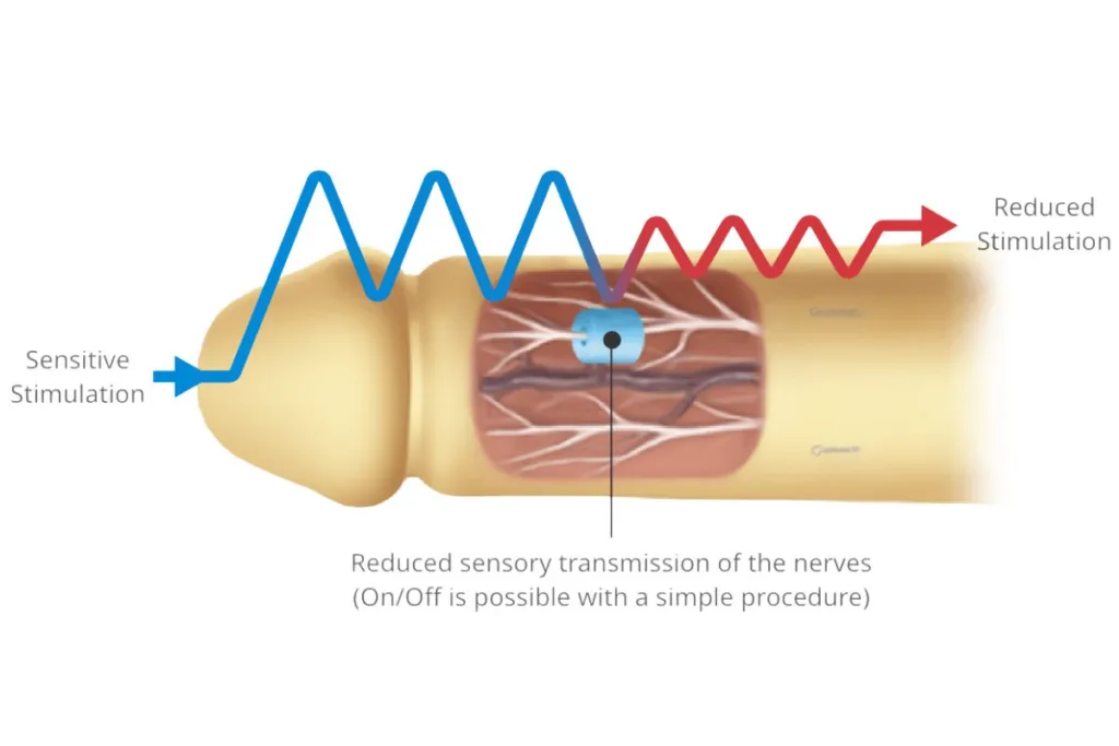 Beyond the Clock: Proven Techniques to Extend Your Sexual Stamina 4