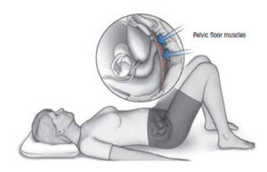 Pelvic Floor Exercises (Kegels)