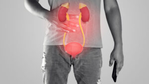 Bladder Tumors
