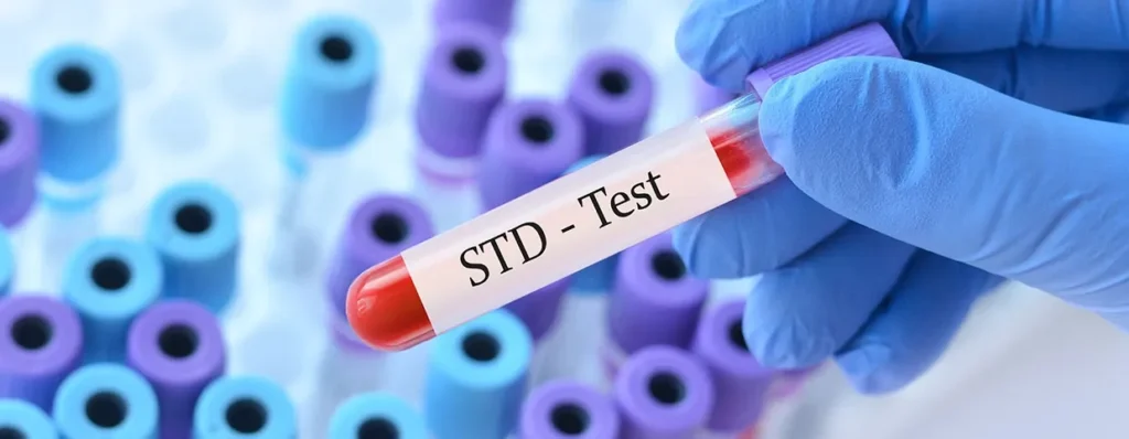 STDs