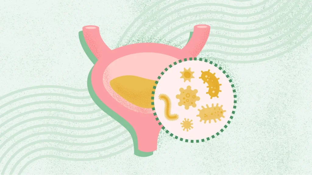 Frequent UTIs