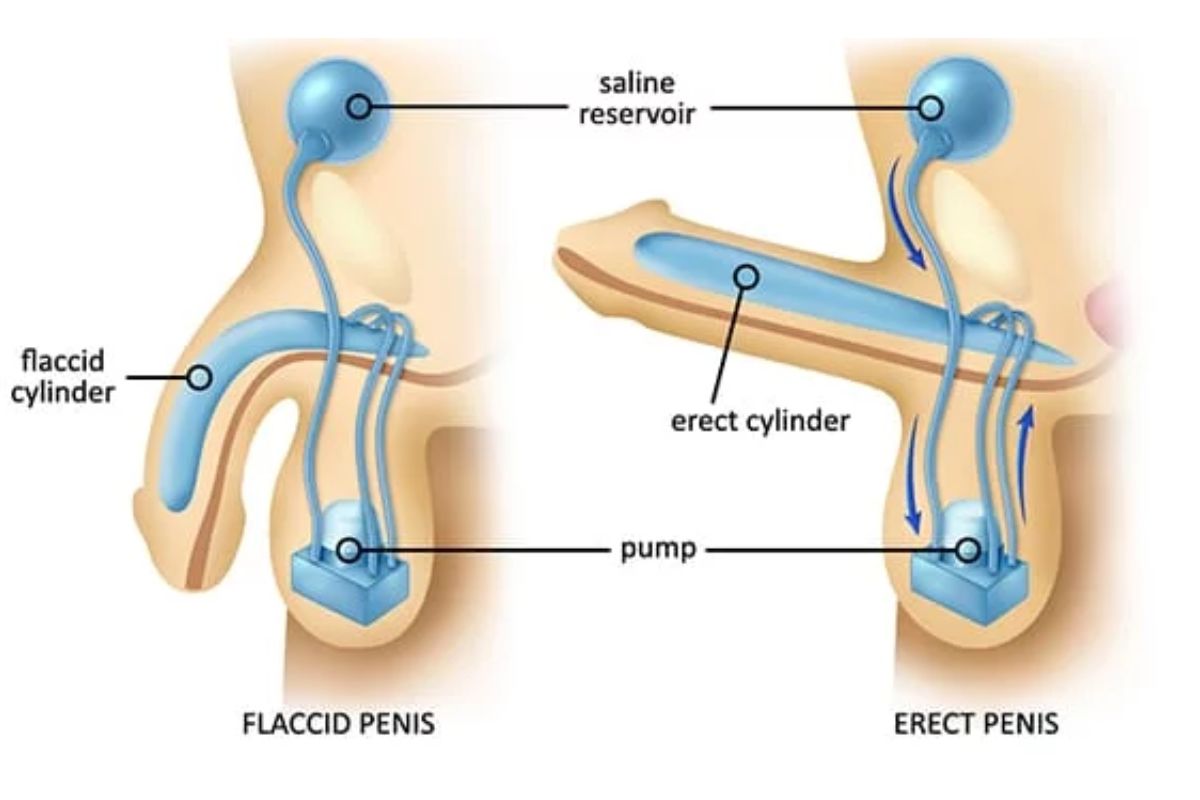 Man in a calm, focused pose, possibly meditating or performing a pelvic floor exercise, symbolizing mental and physical control